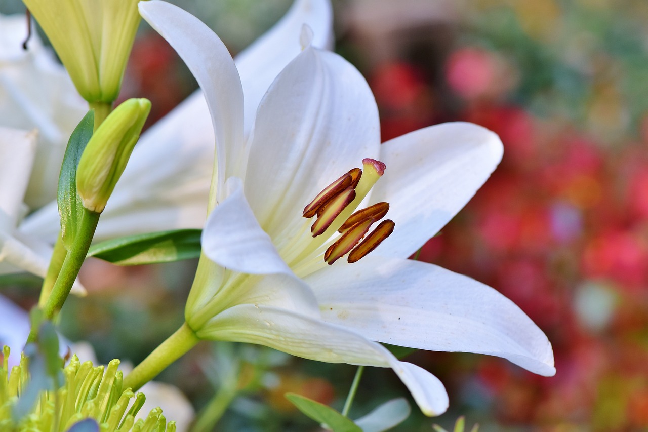 산부인과 수술